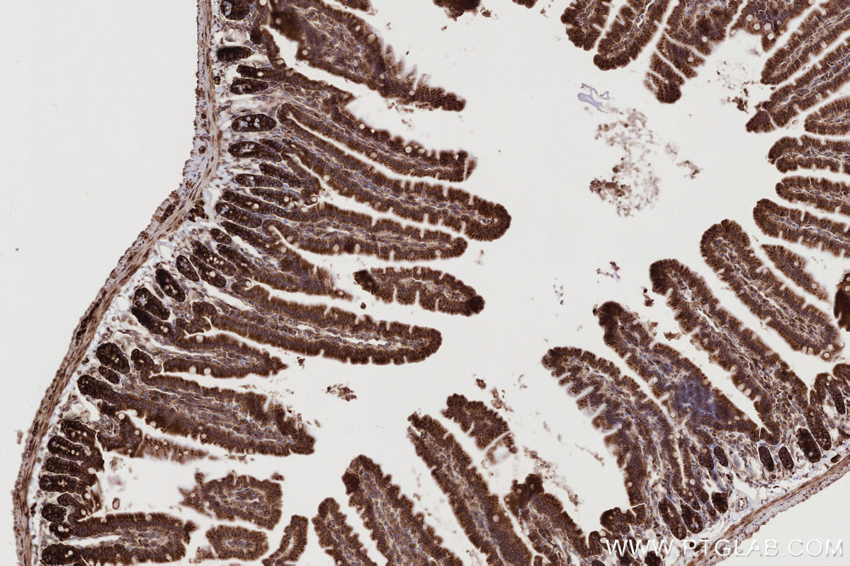 Immunohistochemical analysis of paraffin-embedded mouse small intestine tissue slide using KHC2765 (UPF1 IHC Kit).