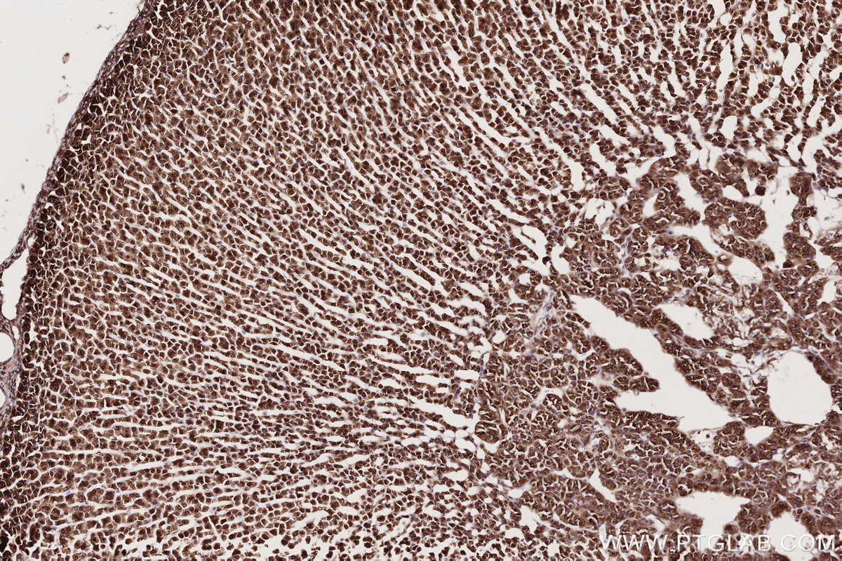 Immunohistochemical analysis of paraffin-embedded rat adrenal gland tissue slide using KHC2765 (UPF1 IHC Kit).