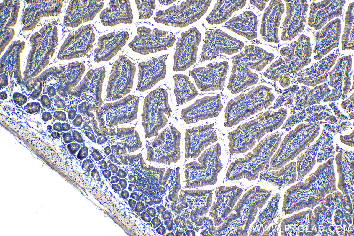 Immunohistochemical analysis of paraffin-embedded mouse small intestine tissue slide using KHC1237 (UPP1 IHC Kit).