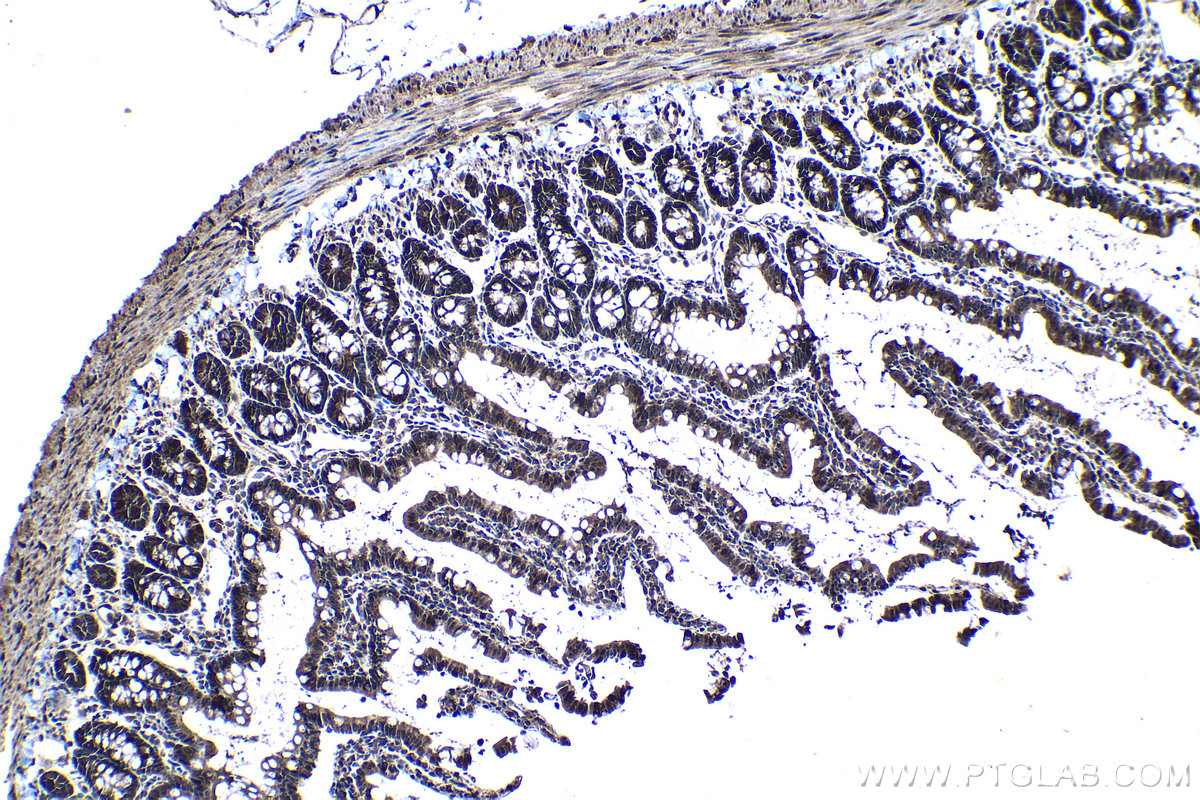 Immunohistochemical analysis of paraffin-embedded rat small intestine tissue slide using KHC1237 (UPP1 IHC Kit).