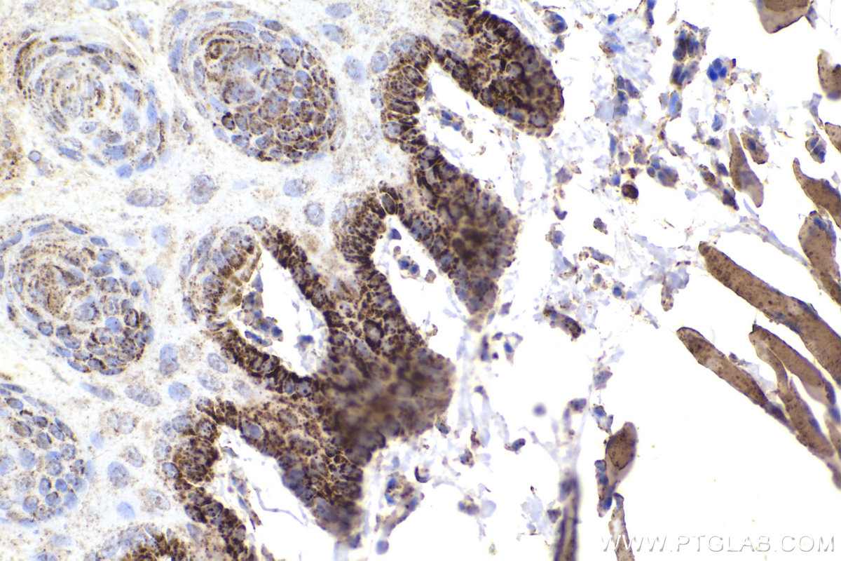 Immunohistochemical analysis of paraffin-embedded rat tongue tissue slide using KHC2209 (UQCRC2 IHC Kit).