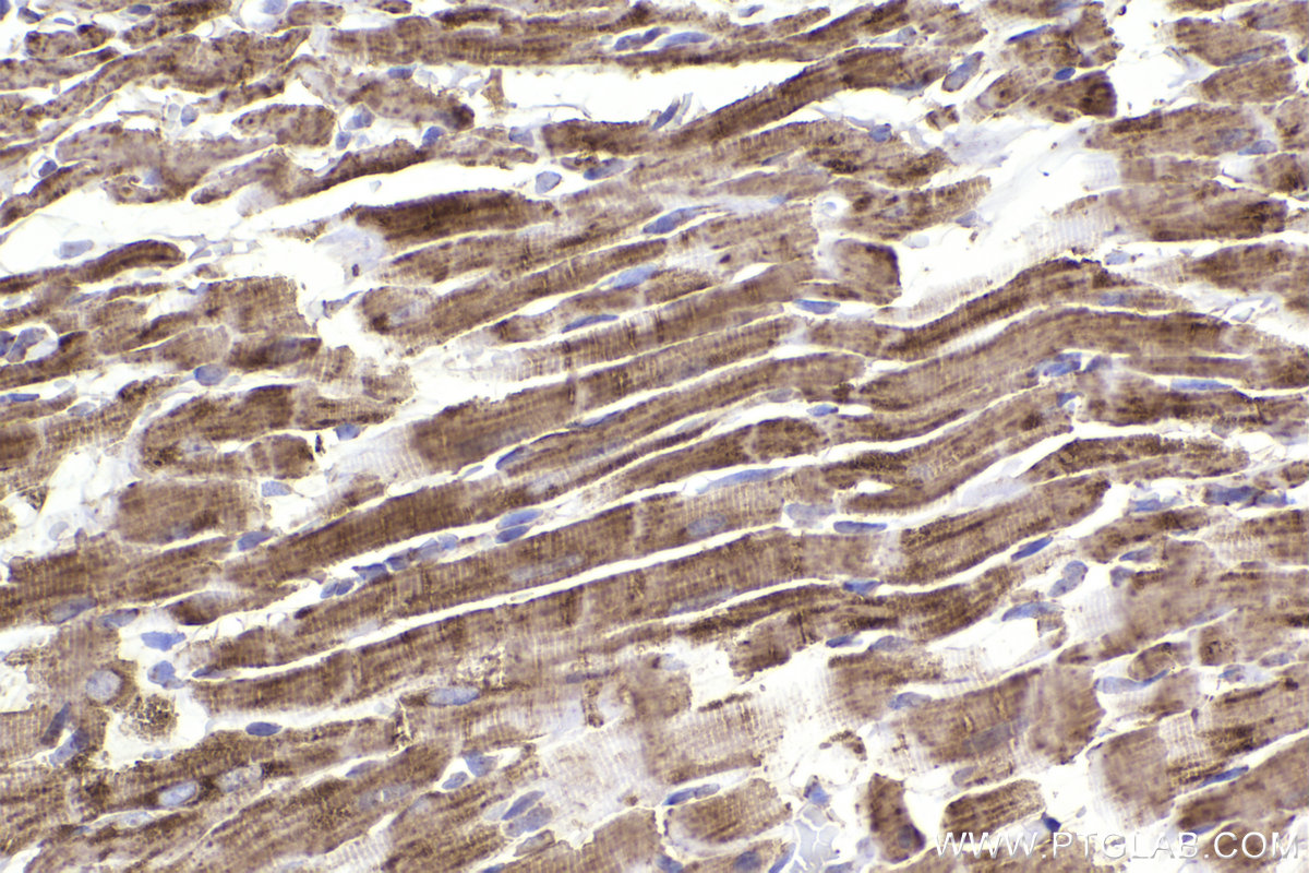Immunohistochemical analysis of paraffin-embedded rat heart tissue slide using KHC2209 (UQCRC2 IHC Kit).