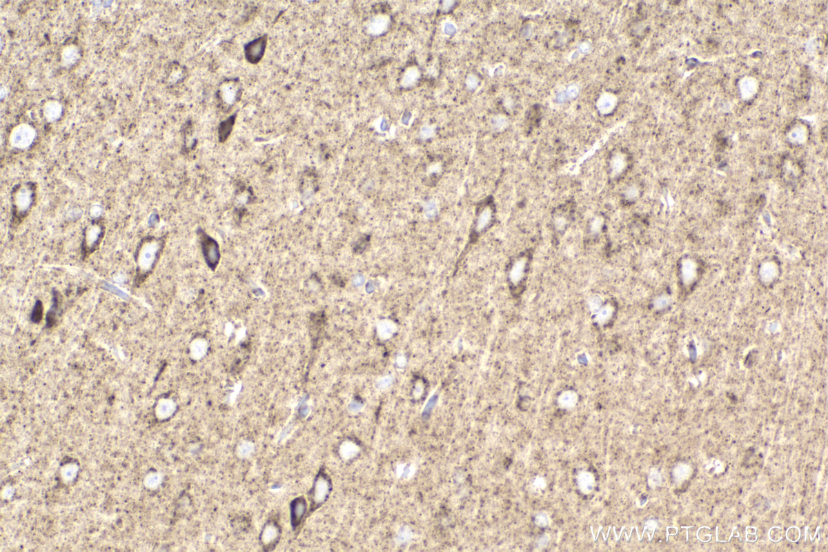 Immunohistochemical analysis of paraffin-embedded rat brain tissue slide using KHC2209 (UQCRC2 IHC Kit).