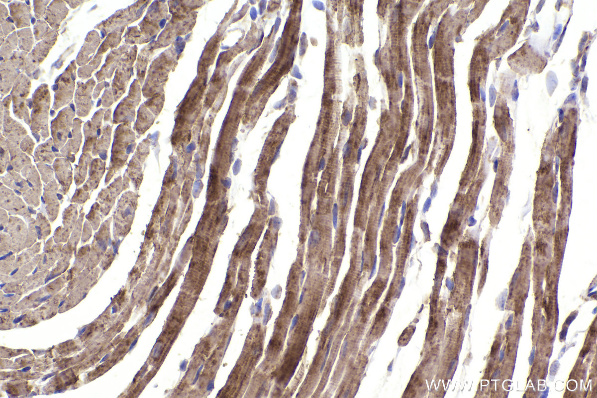 Immunohistochemical analysis of paraffin-embedded mouse heart tissue slide using KHC2209 (UQCRC2 IHC Kit).