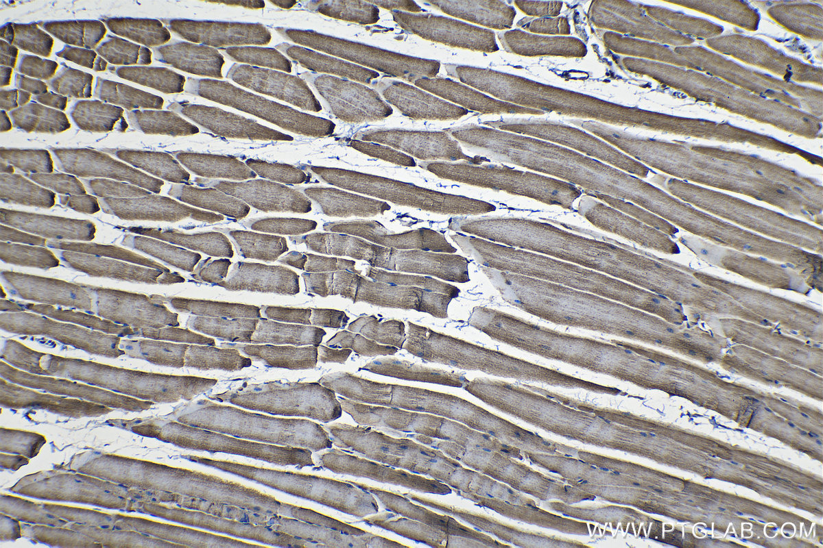 Immunohistochemical analysis of paraffin-embedded mouse skeletal muscle tissue slide using KHC1275 (UQCRFS1 IHC Kit).