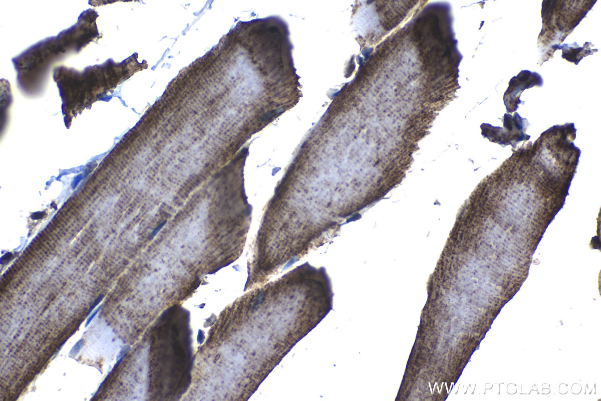 Immunohistochemical analysis of paraffin-embedded rat skeletal muscle tissue slide using KHC1275 (UQCRFS1 IHC Kit).