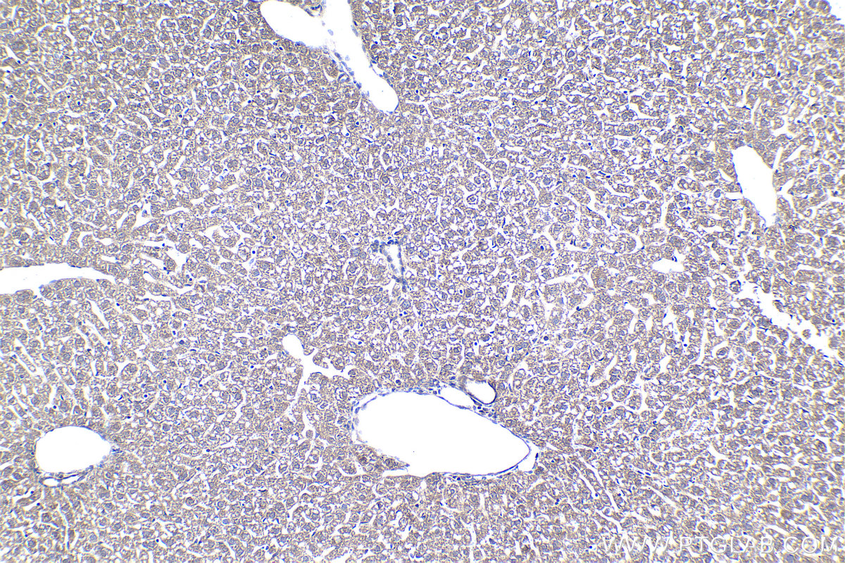 Immunohistochemical analysis of paraffin-embedded mouse liver tissue slide using KHC1374 (UQCRQ IHC Kit).