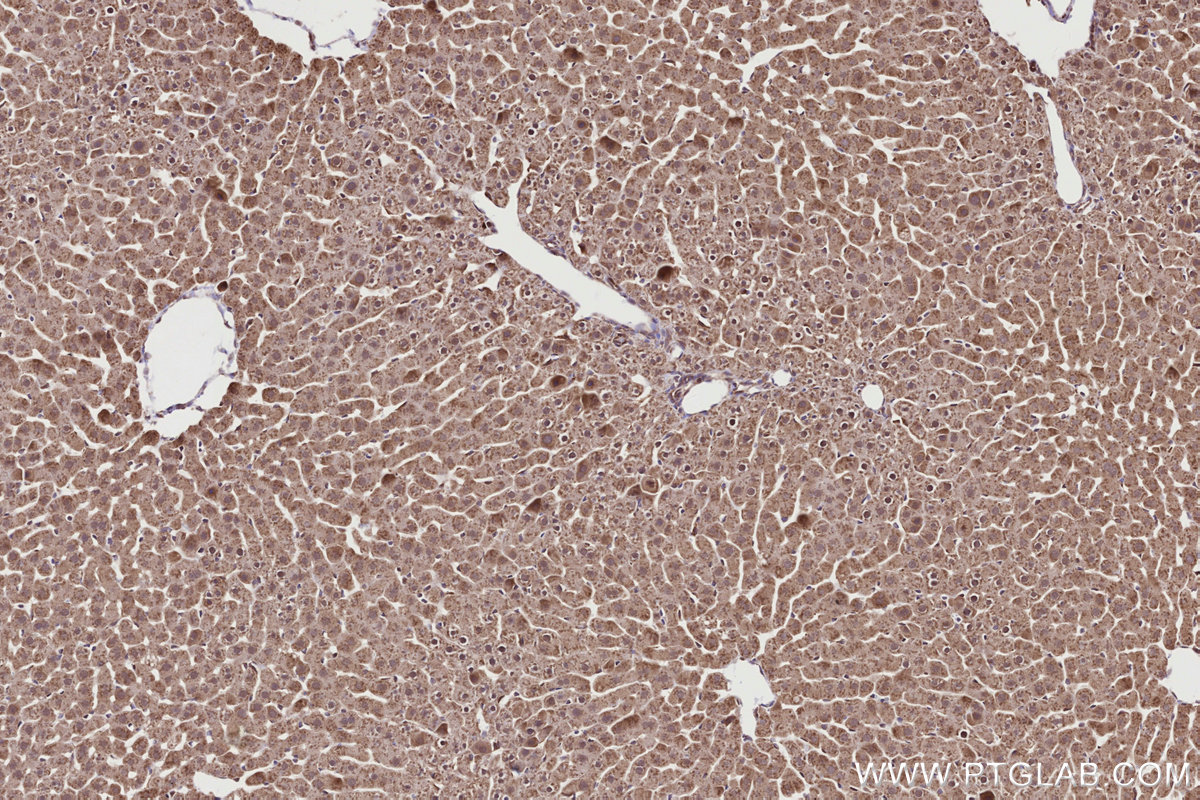 Immunohistochemical analysis of paraffin-embedded rat liver tissue slide using KHC2714 (URG4 IHC Kit).
