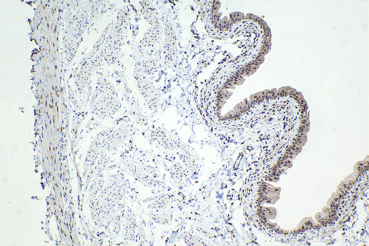 Immunohistochemical analysis of paraffin-embedded rat bladder tissue slide using KHC1557 (USF1 IHC Kit).