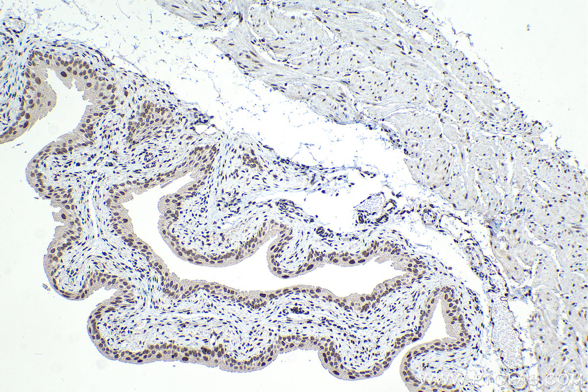 Immunohistochemical analysis of paraffin-embedded mouse bladder tissue slide using KHC1557 (USF1 IHC Kit).