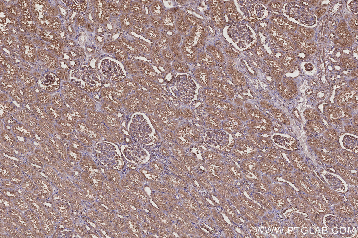 Immunohistochemical analysis of paraffin-embedded human kidney tissue slide using KHC3095 (USH1C IHC Kit). Immunohistochemical analysis of paraffin-embedded human kidney tissue slide using KHC3095 (USH1C IHC Kit).