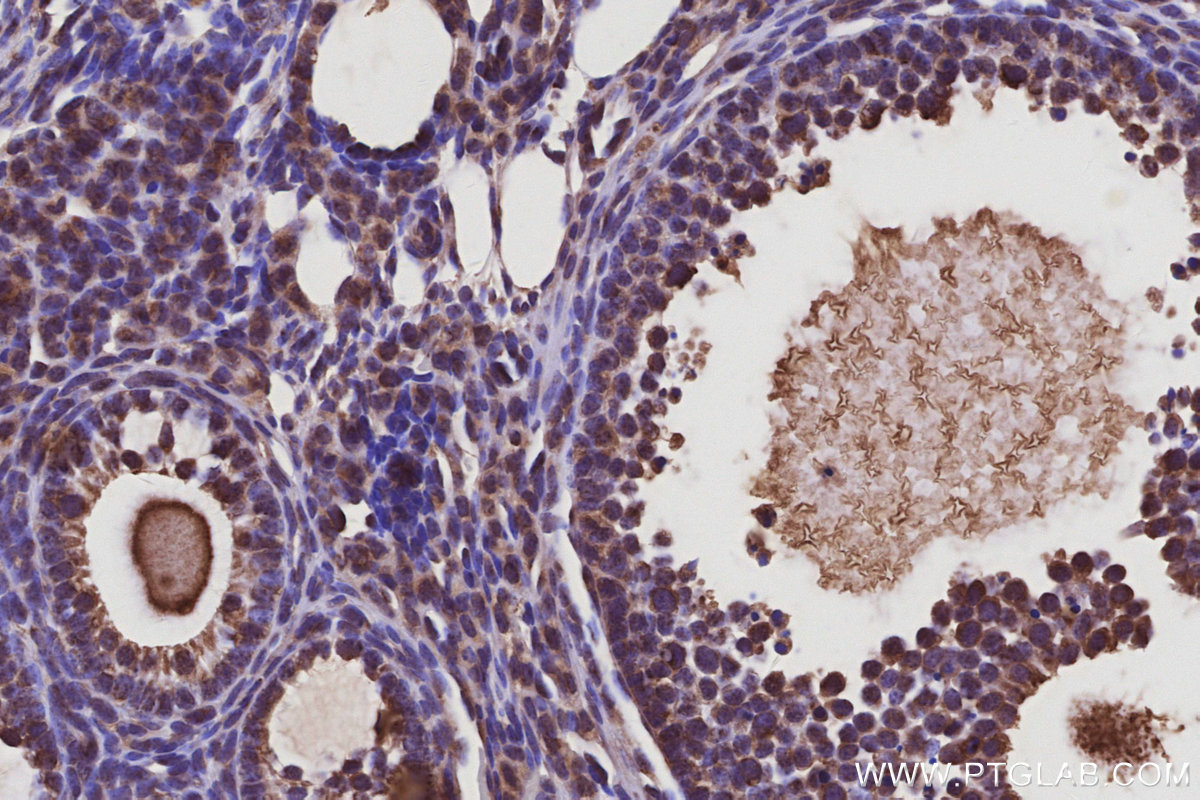 Immunohistochemical analysis of paraffin-embedded mouse ovary tissue slide using KHC3095 (USH1C IHC Kit). Immunohistochemical analysis of paraffin-embedded mouse ovary tissue slide using KHC3095 (USH1C IHC Kit).