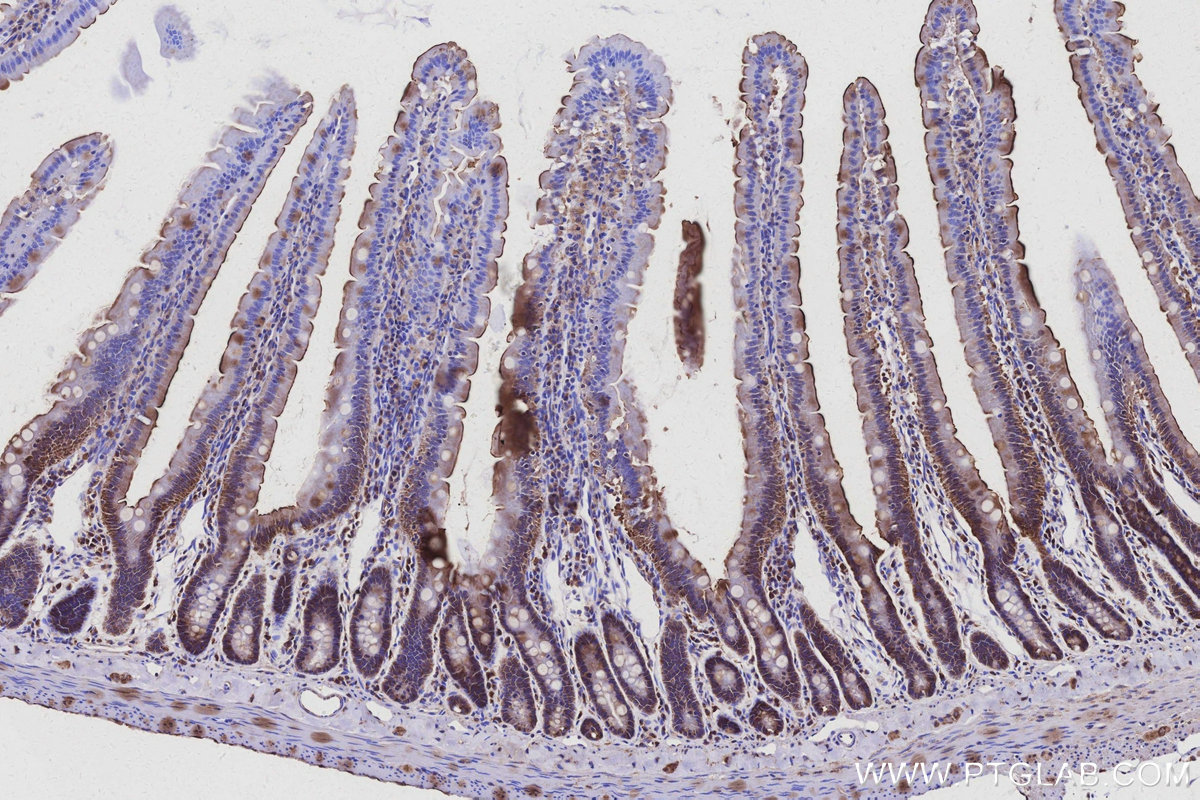 Immunohistochemical analysis of paraffin-embedded rat small intestine tissue slide using KHC3095 (USH1C IHC Kit). Immunohistochemical analysis of paraffin-embedded rat small intestine tissue slide using KHC3095 (USH1C IHC Kit).