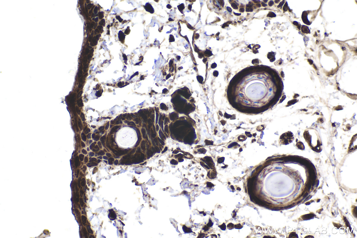 Immunohistochemical analysis of paraffin-embedded rat skin tissue slide using KHC1770 (USH1G IHC Kit).