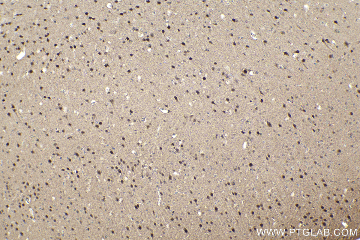 Immunohistochemical analysis of paraffin-embedded mouse brain tissue slide using KHC1026 (USP11 IHC Kit).