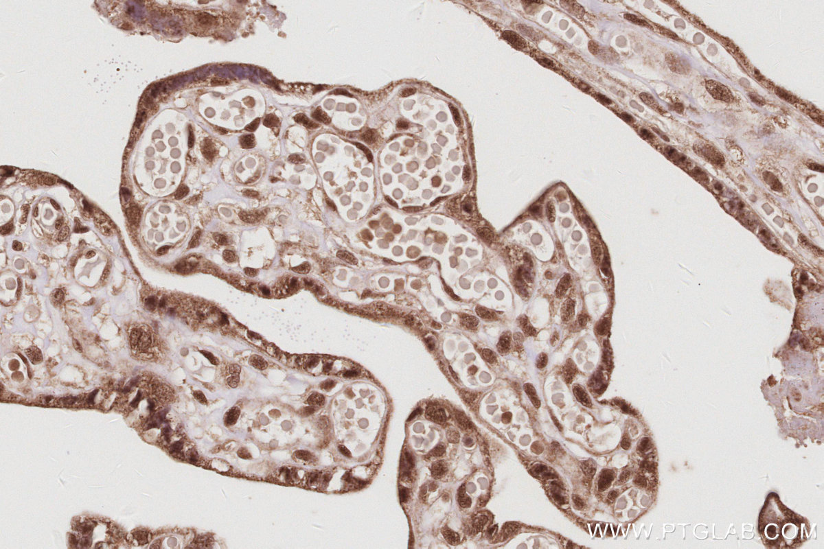 Immunohistochemical analysis of paraffin-embedded human placenta tissue slide using KHC3083 (USP16 IHC Kit).