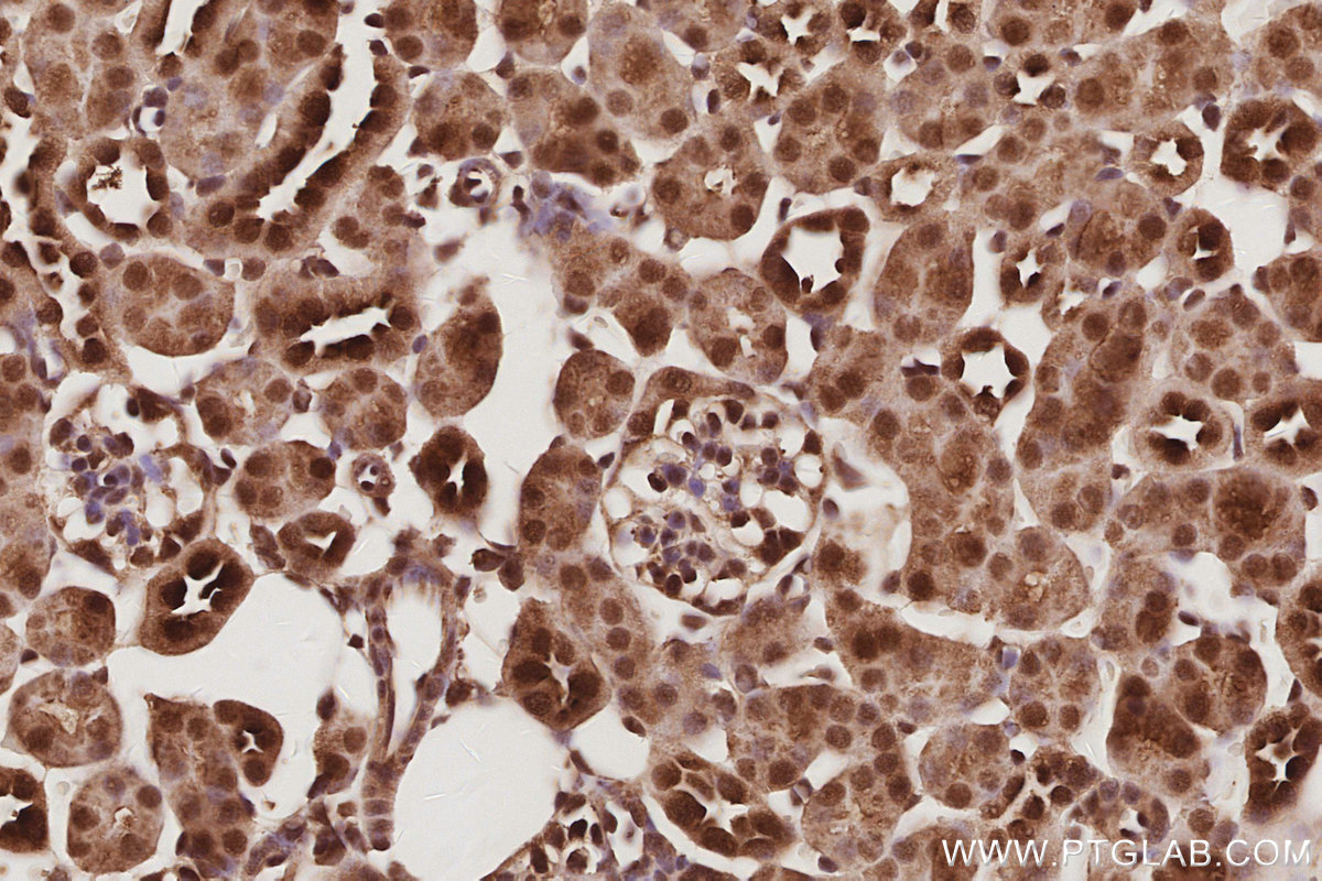 Immunohistochemical analysis of paraffin-embedded mouse kidney tissue slide using KHC3083 (USP16 IHC Kit).