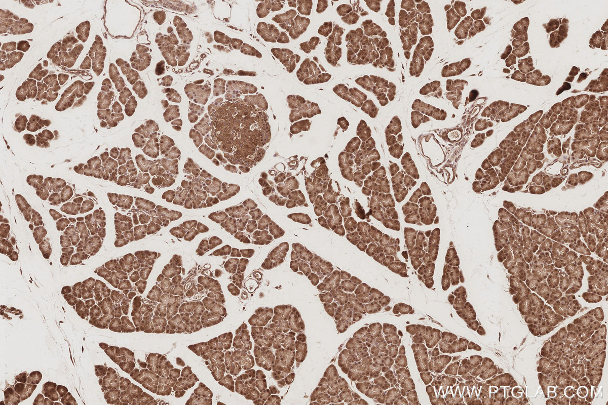 Immunohistochemical analysis of paraffin-embedded rat pancreas tissue slide using KHC3083 (USP16 IHC Kit).