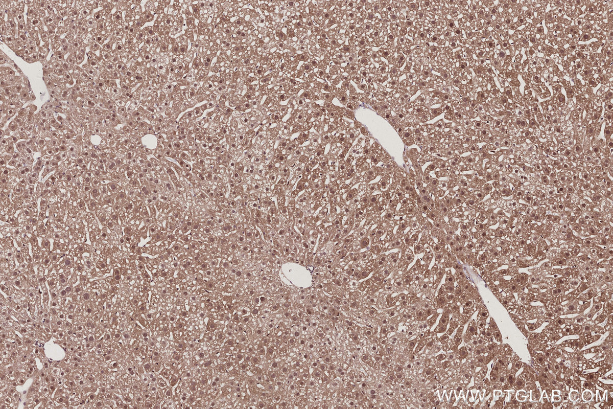 Immunohistochemical analysis of paraffin-embedded mouse liver tissue slide using KHC3047 (USP24 IHC Kit). Immunohistochemical analysis of paraffin-embedded mouse liver tissue slide using KHC3047 (USP24 IHC Kit).