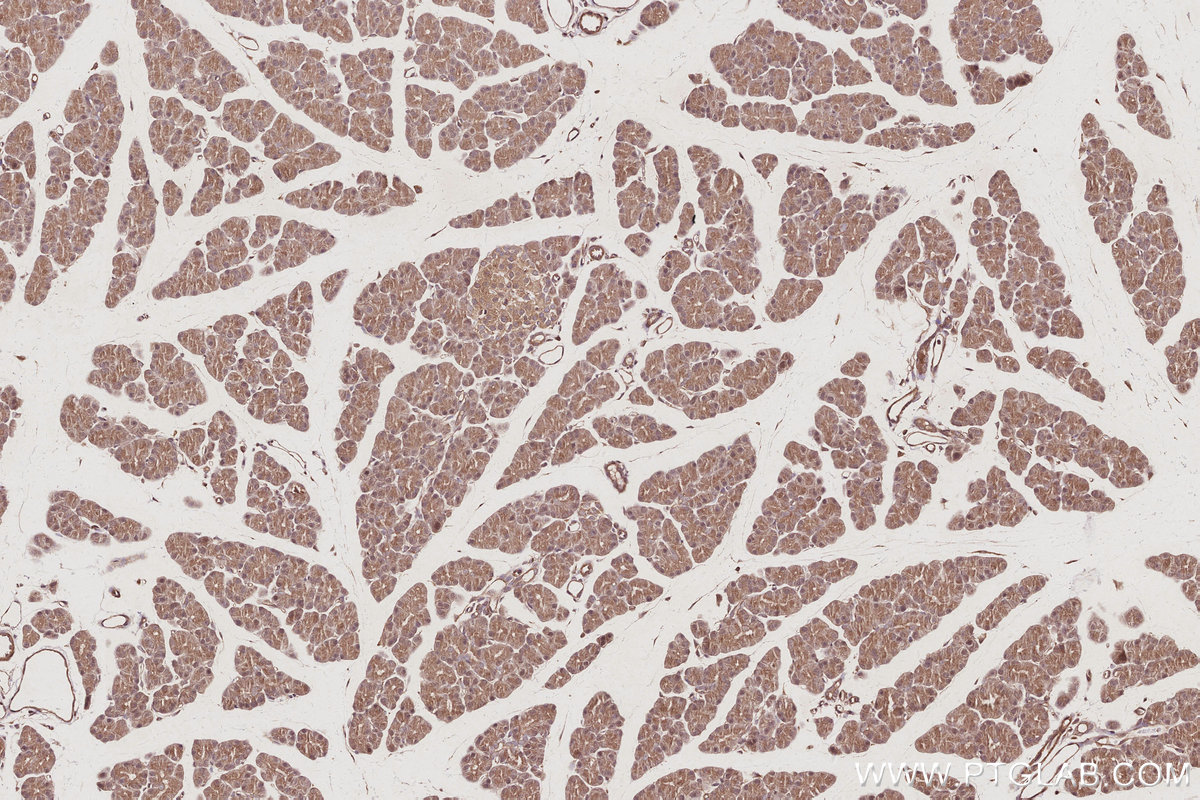 Immunohistochemical analysis of paraffin-embedded rat pancreas tissue slide using KHC3047 (USP24 IHC Kit). Immunohistochemical analysis of paraffin-embedded rat pancreas tissue slide using KHC3047 (USP24 IHC Kit).