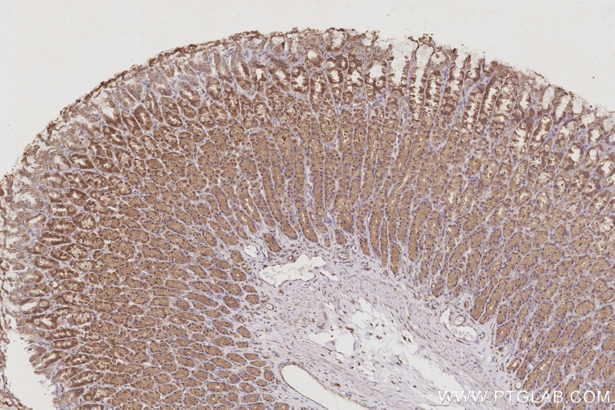 Immunohistochemical analysis of paraffin-embedded rat stomach tissue slide using KHC3047 (USP24 IHC Kit). Immunohistochemical analysis of paraffin-embedded rat stomach tissue slide using KHC3047 (USP24 IHC Kit).