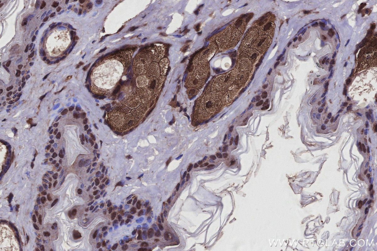 Immunohistochemical analysis of paraffin-embedded mouse skin tissue slide using KHC2929 (USP29 IHC Kit).