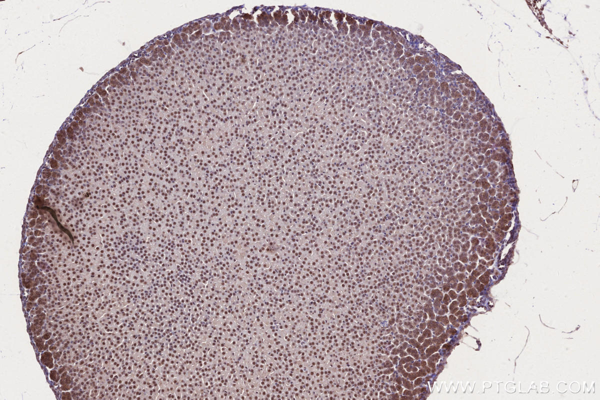 Immunohistochemical analysis of paraffin-embedded mouse adrenal gland tissue slide using KHC2631 (USP37 IHC Kit).