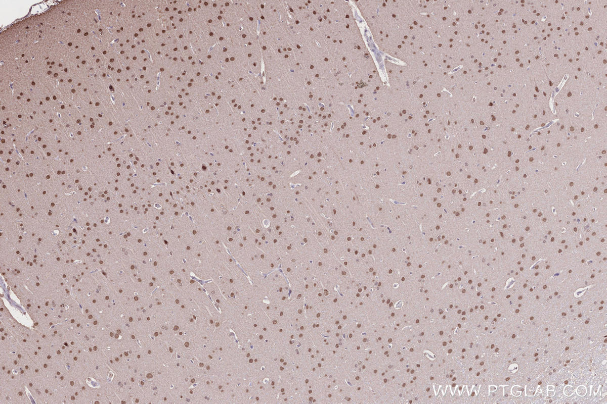 Immunohistochemical analysis of paraffin-embedded rat brain tissue slide using KHC2631 (USP37 IHC Kit).