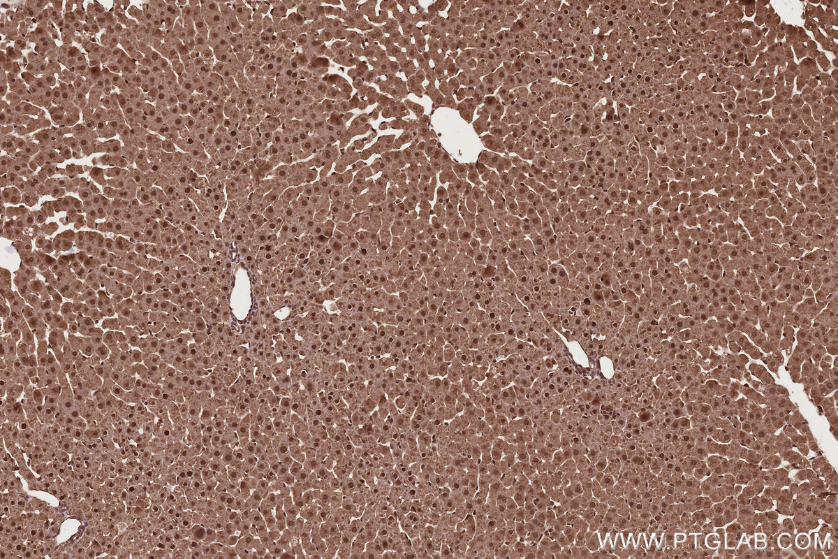 Immunohistochemical analysis of paraffin-embedded rat liver tissue slide using KHC2685 (USP38 IHC Kit).