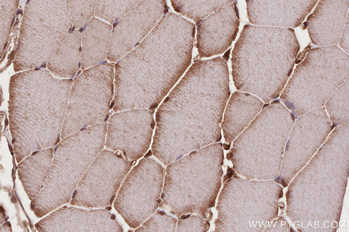 Immunohistochemical analysis of paraffin-embedded rat skeletal muscle tissue slide using KHC2685 (USP38 IHC Kit).