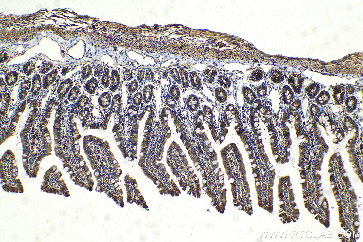 Immunohistochemical analysis of paraffin-embedded rat small intestine tissue slide using KHC2110 (VAMP4 IHC Kit).