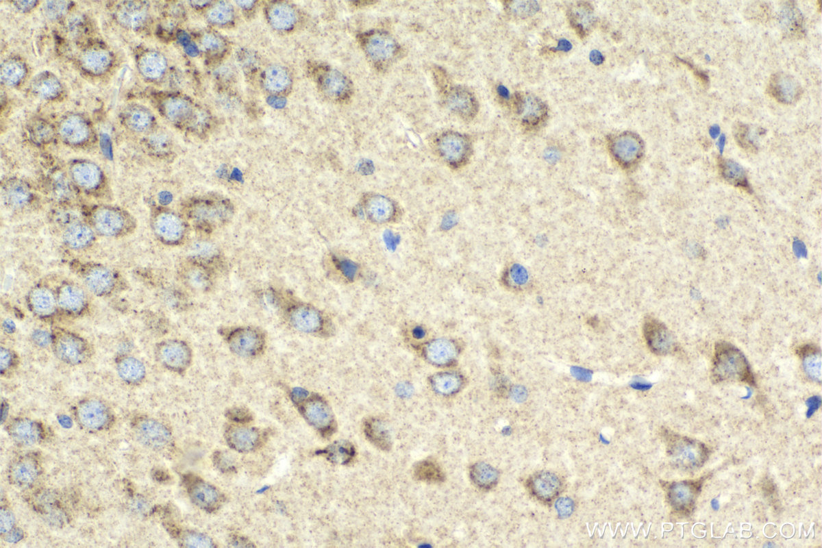 Immunohistochemical analysis of paraffin-embedded rat brain tissue slide using KHC2110 (VAMP4 IHC Kit).
