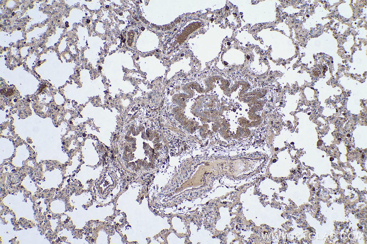 Immunohistochemical analysis of paraffin-embedded rat lung tissue slide using KHC0472 (VAMP5 IHC Kit).