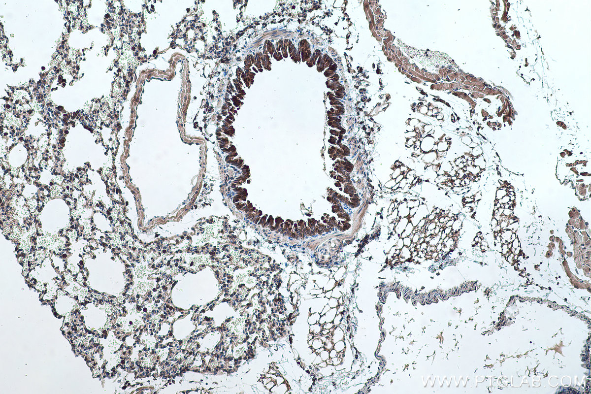 Immunohistochemical analysis of paraffin-embedded mouse lung tissue slide using KHC0472 (VAMP5 IHC Kit).