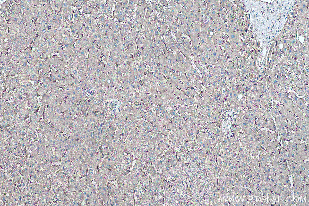 Immunohistochemical analysis of paraffin-embedded human liver tissue slide using KHC0472 (VAMP5 IHC Kit).