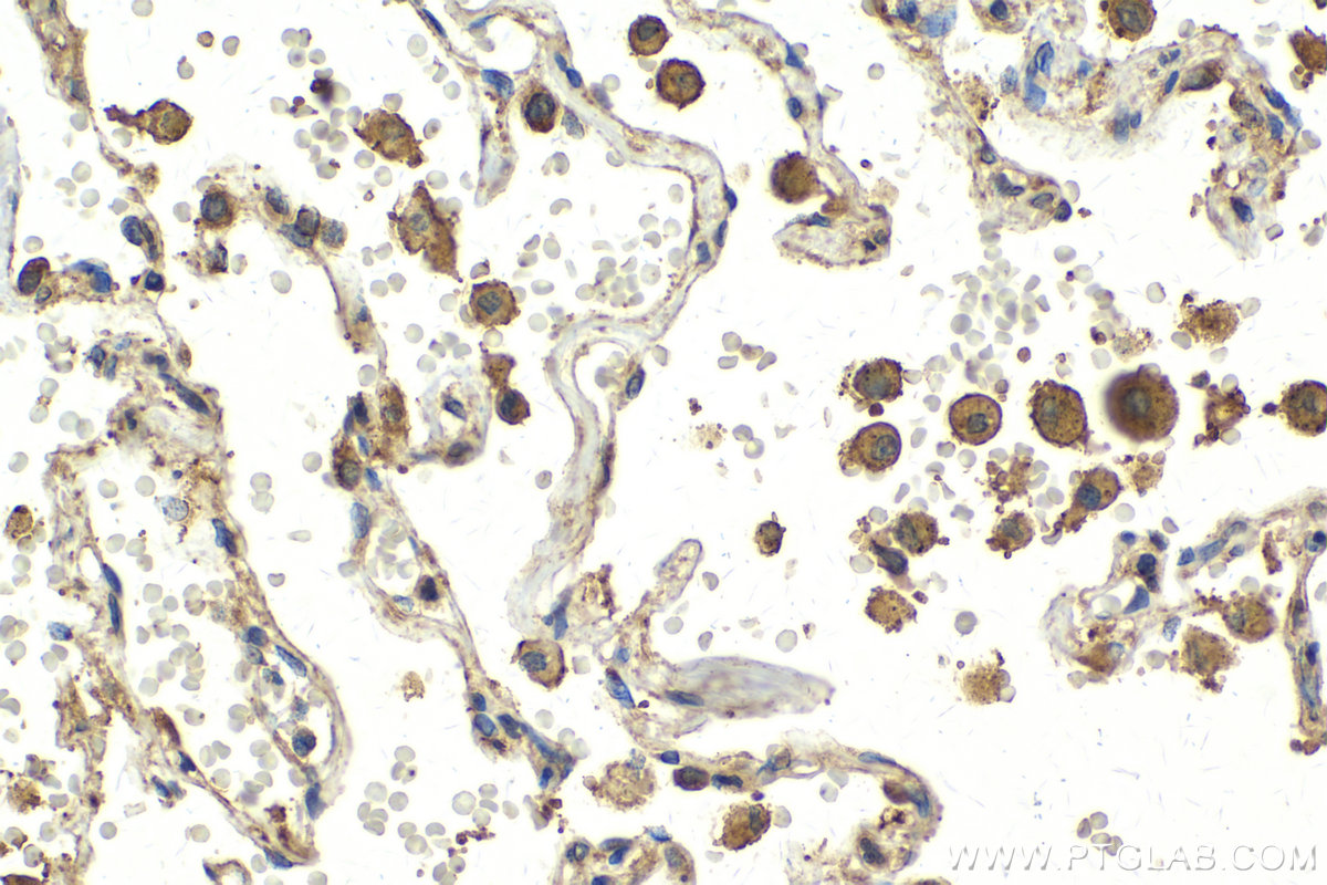 Immunohistochemical analysis of paraffin-embedded human lung tissue slide using KHC2142 (VAPB IHC Kit).