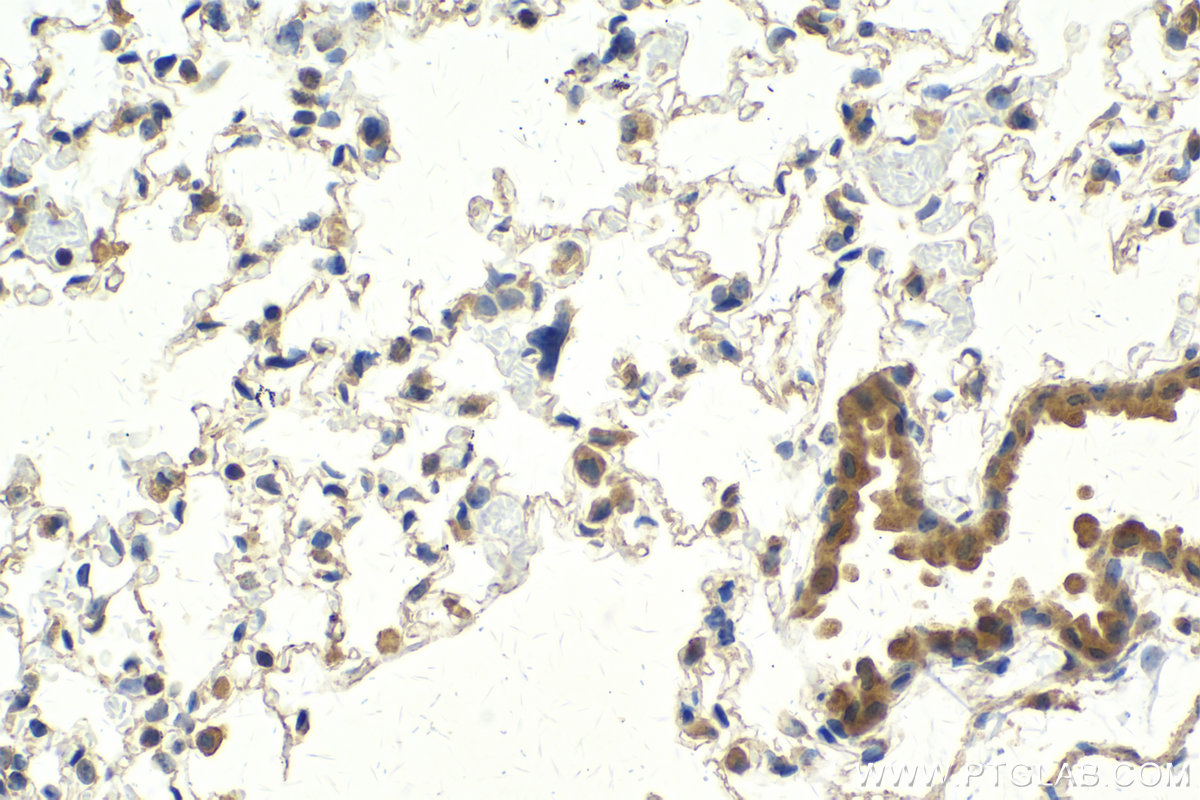 Immunohistochemical analysis of paraffin-embedded mouse lung tissue slide using KHC2142 (VAPB IHC Kit).