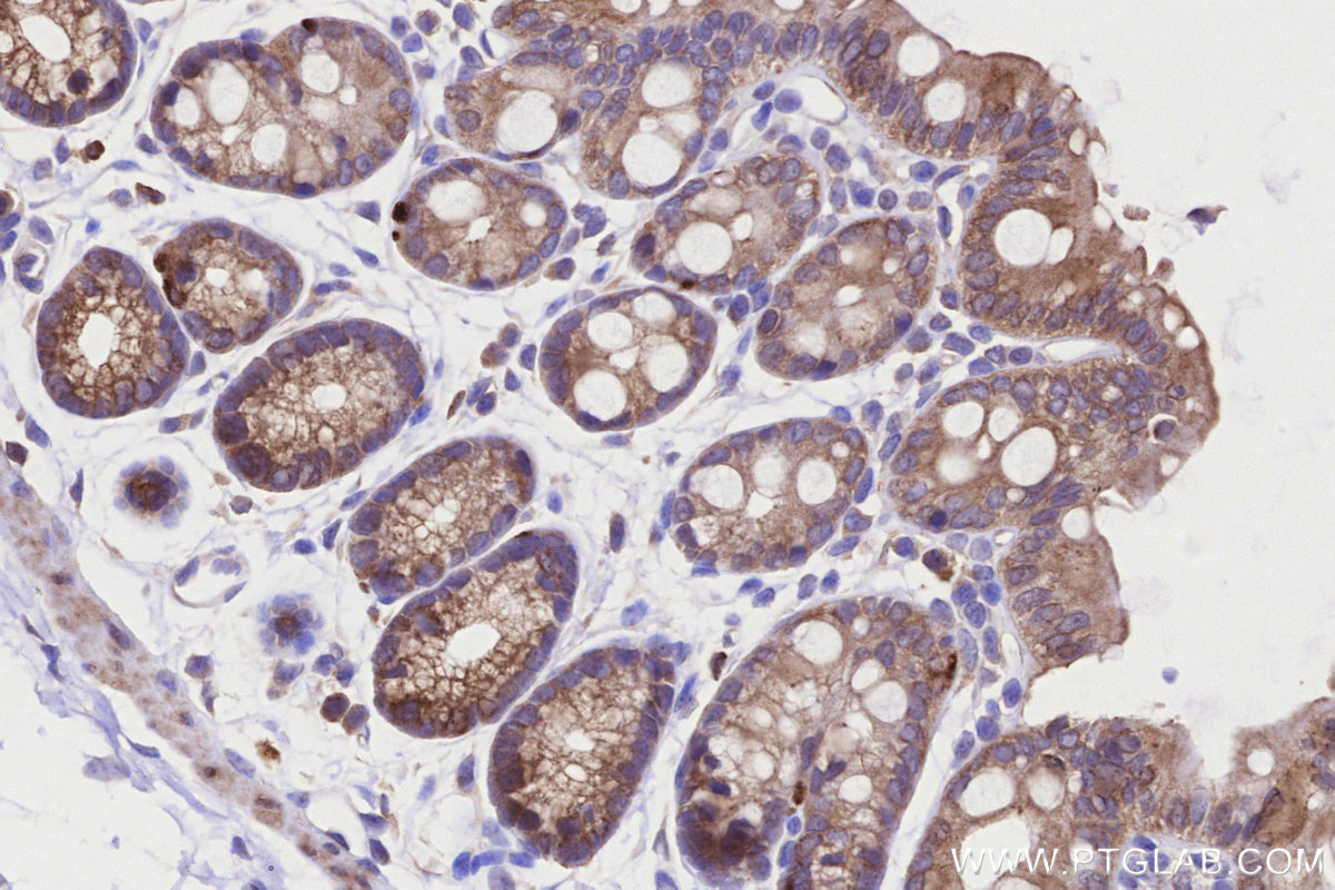 Immunohistochemical analysis of paraffin-embedded mouse colon tissue slide using KHC3220 (VASP IHC Kit). Immunohistochemical analysis of paraffin-embedded mouse colon tissue slide using KHC3220 (VASP IHC Kit).