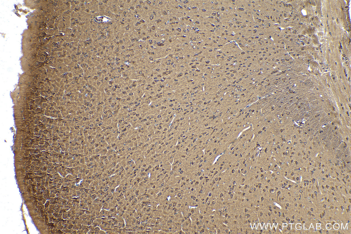 Immunohistochemical analysis of paraffin-embedded mouse brain tissue slide using KHC0944 (VBP1 IHC Kit).