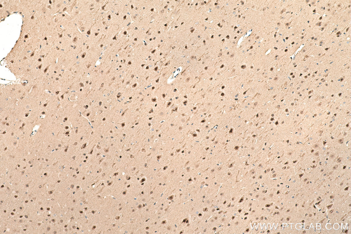 Immunohistochemical analysis of paraffin-embedded rat brain tissue slide using KHC0830 (VCP IHC Kit).