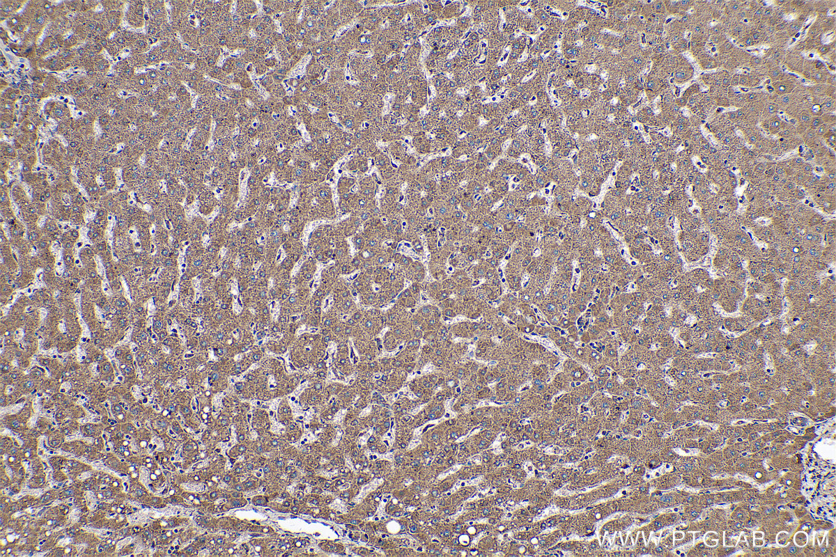 Immunohistochemical analysis of paraffin-embedded human liver tissue slide using KHC0588 (VDAC1/2 IHC Kit).