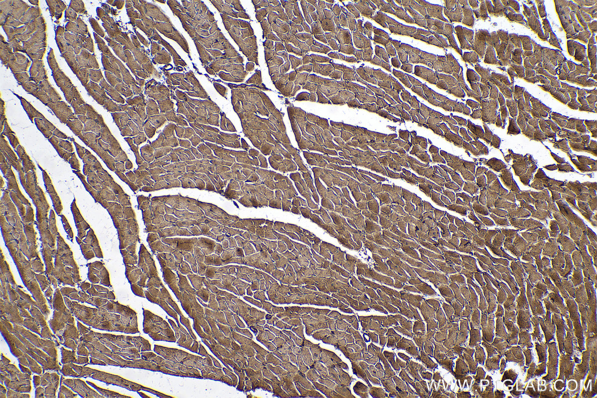 Immunohistochemical analysis of paraffin-embedded mouse heart tissue slide using KHC0588 (VDAC1/2 IHC Kit).