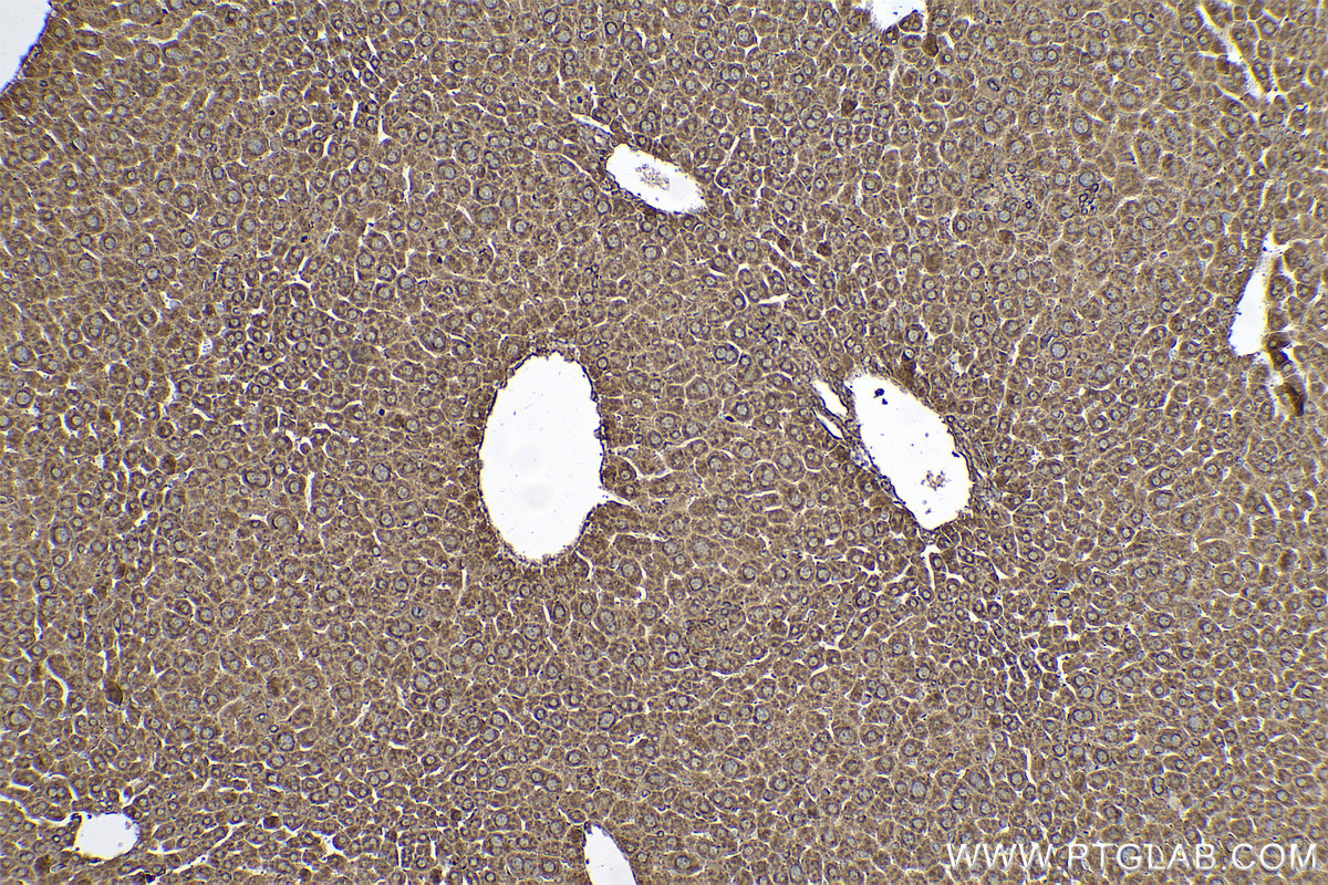 Immunohistochemical analysis of paraffin-embedded mouse liver tissue slide using KHC0588 (VDAC1/2 IHC Kit).