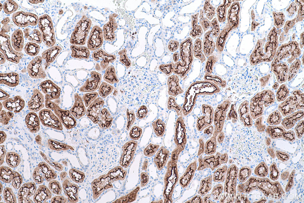 Immunohistochemical analysis of paraffin-embedded human kidney tissue slide using KHC0601 (VIL1 IHC Kit).