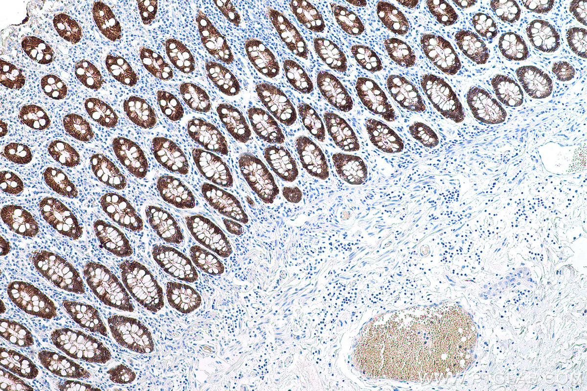 Immunohistochemical analysis of paraffin-embedded human colon tissue slide using KHC0601 (VIL1 IHC Kit).