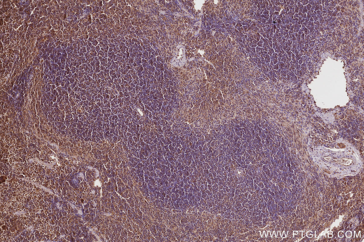 Immunohistochemical analysis of paraffin-embedded mouse spleen tissue slide using KHC2843 (VPS15 IHC Kit).