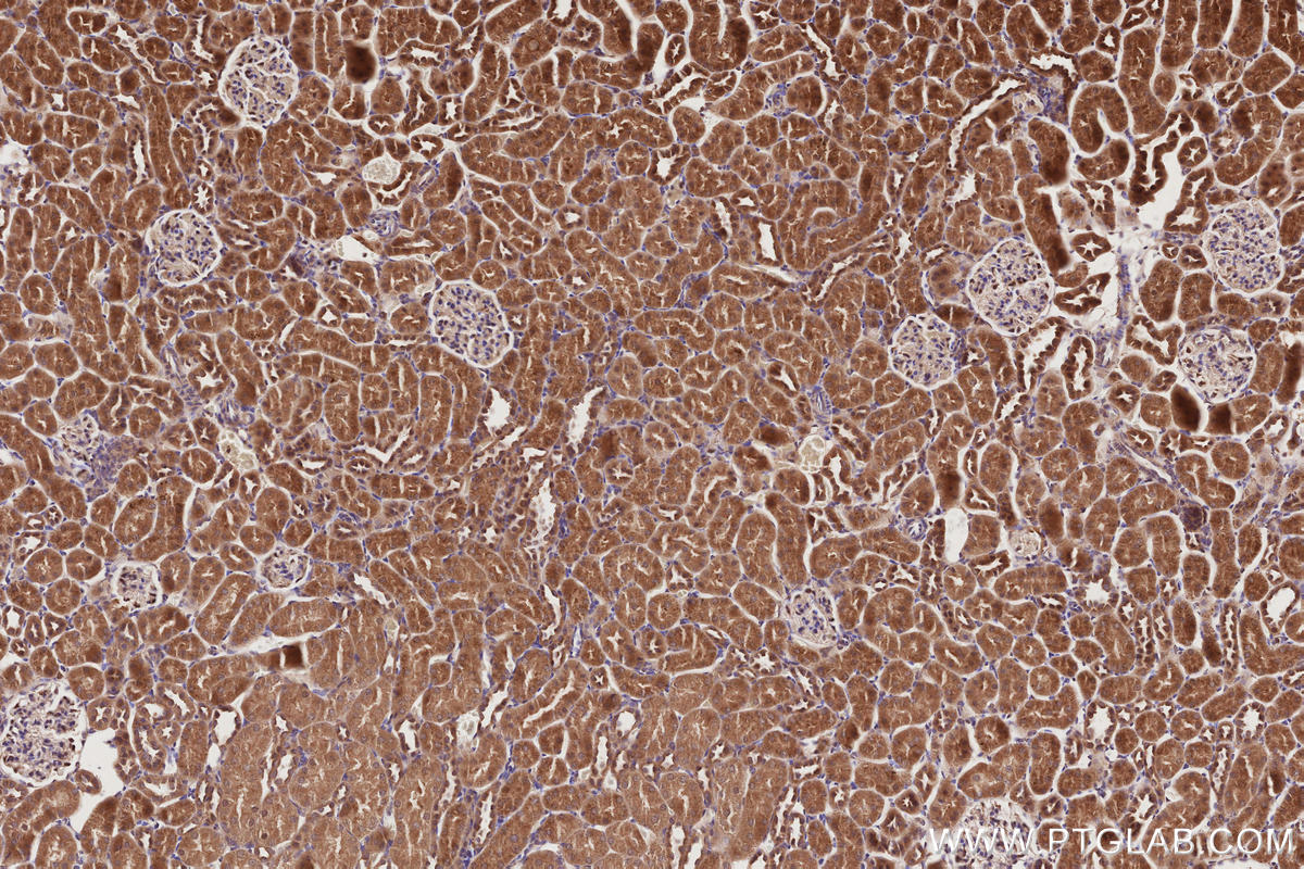 Immunohistochemical analysis of paraffin-embedded rat kidney tissue slide using KHC2843 (VPS15 IHC Kit).