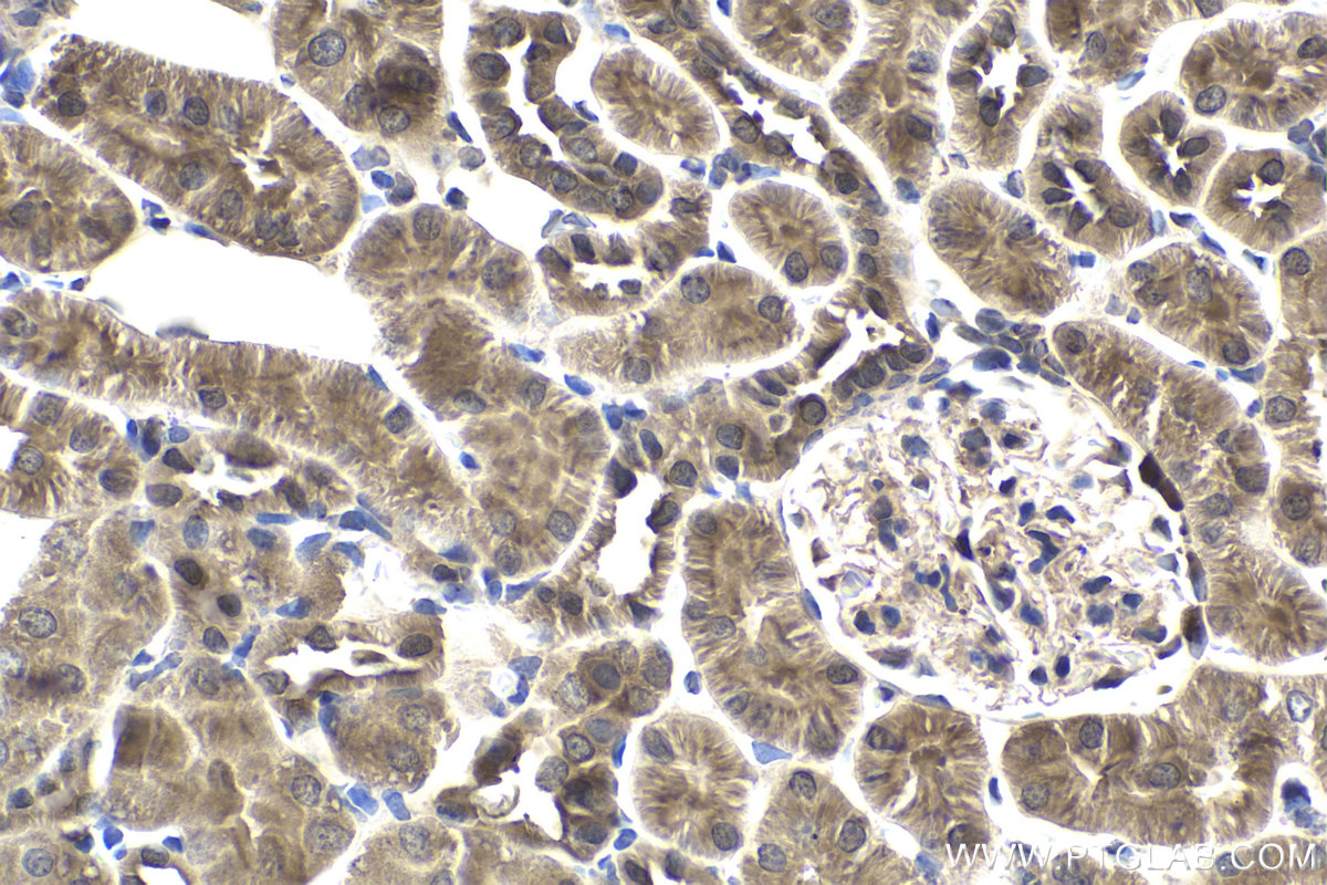 Immunohistochemical analysis of paraffin-embedded rat kidney tissue slide using KHC1900 (VPS25 IHC Kit).