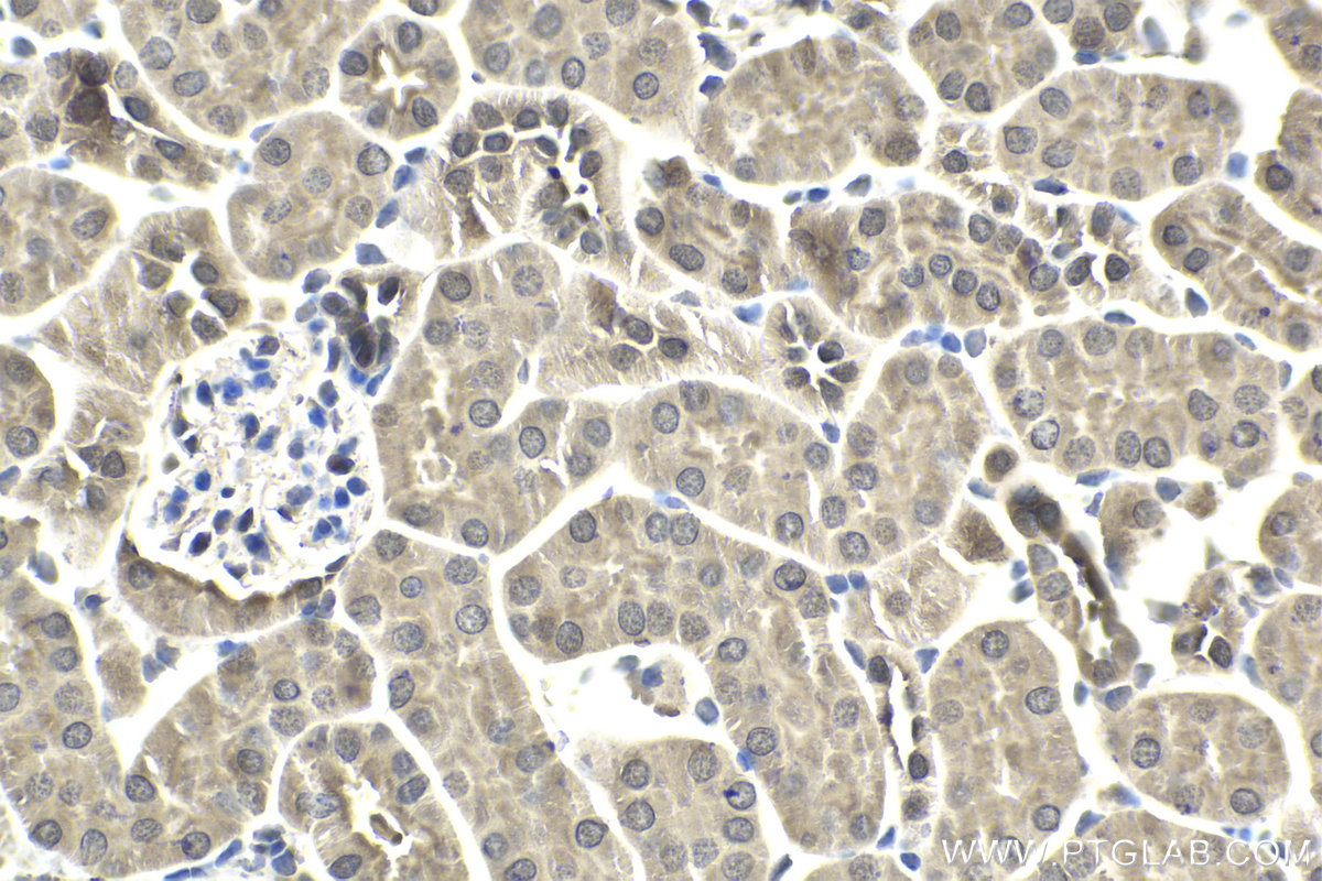 Immunohistochemical analysis of paraffin-embedded mouse kidney tissue slide using KHC1900 (VPS25 IHC Kit).