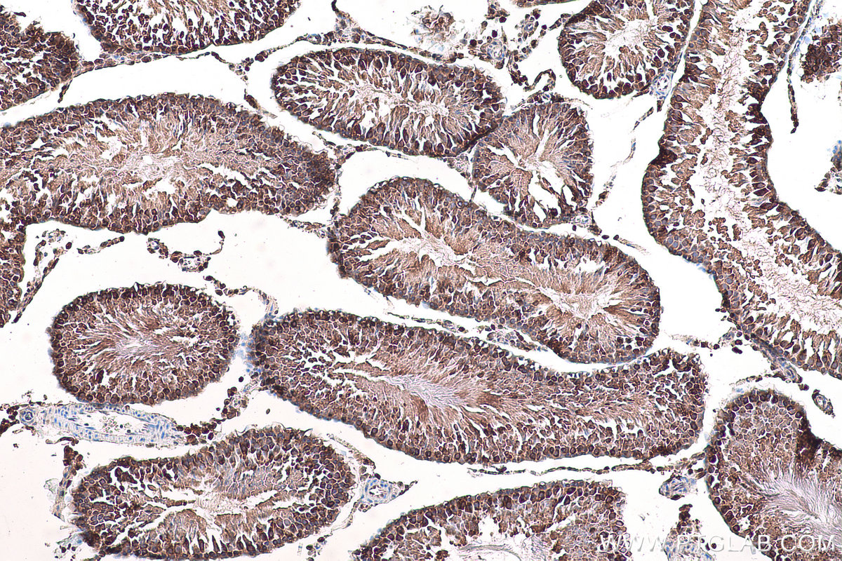 Immunohistochemical analysis of paraffin-embedded rat testis tissue slide using KHC0961 (VPS26A IHC Kit).